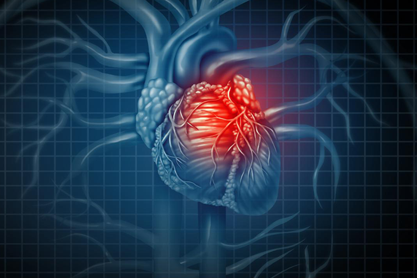 Blue Graphic of the Heart With A Heart Attack Highlighted in Red