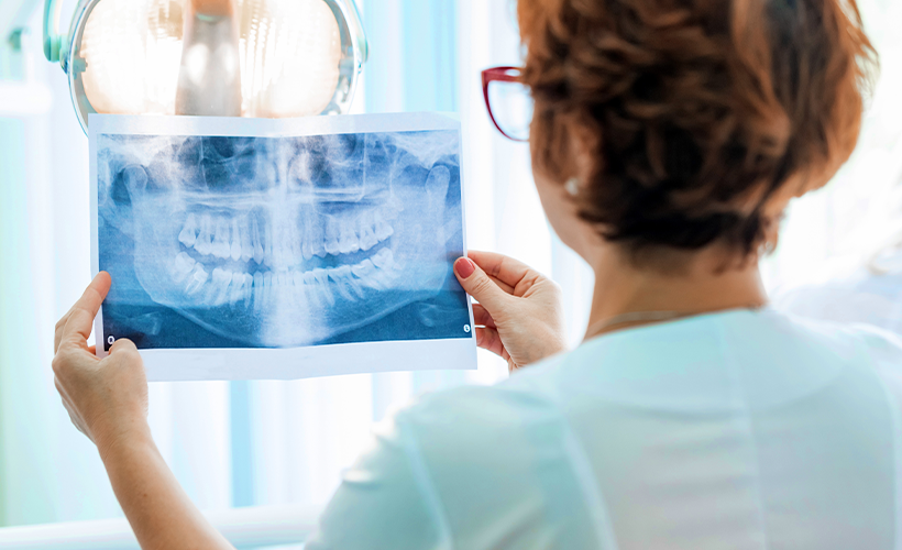 dentist looking at X-ray for periodontal disease