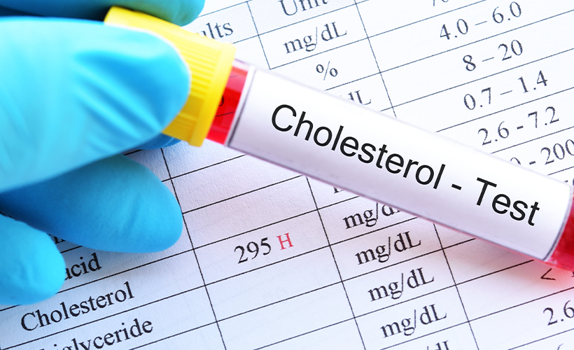 A cholesterol test can help monitor HDL and LDL levels, helping you live a healthier life.