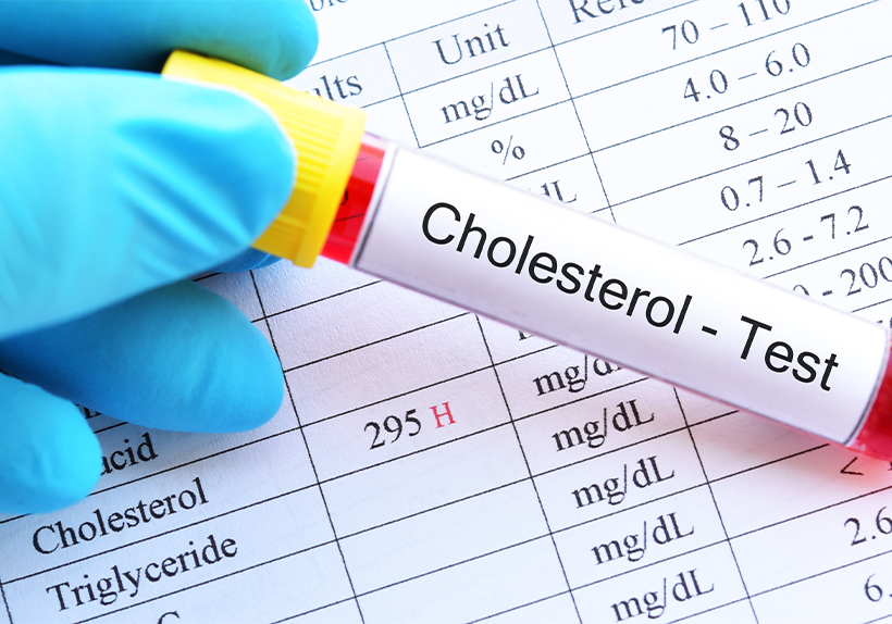 A cholesterol test can help monitor HDL and LDL levels, helping you live a healthier life.