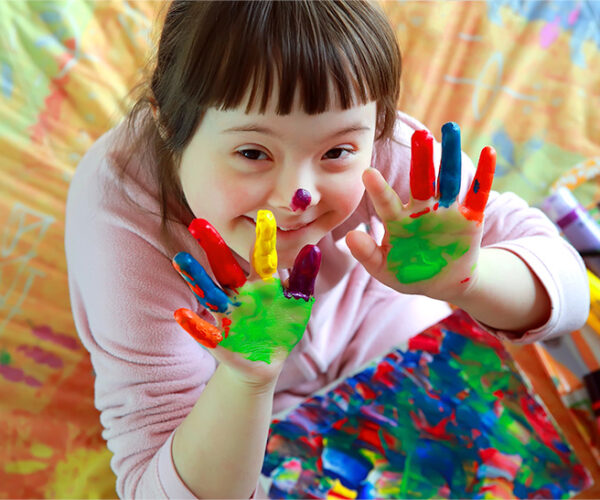 Down-Syndrome-Blog