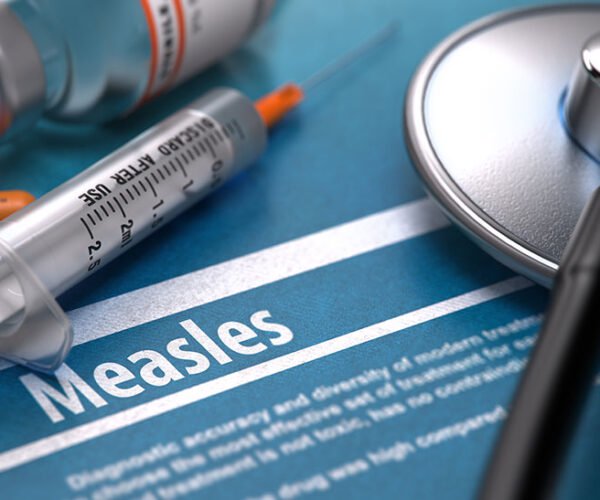 Understanding-Measles-Blog-2025